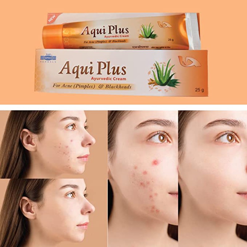 Aqui Plus For Acne, BlackSpot, Scars, Blackhead and Pimple Ayurvedic Treatment--0